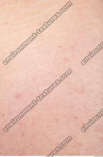 human skin white 0022